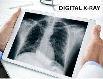 Digital X -Ray