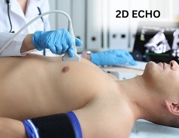 2D Echo